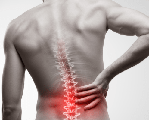 back pain chiropractor